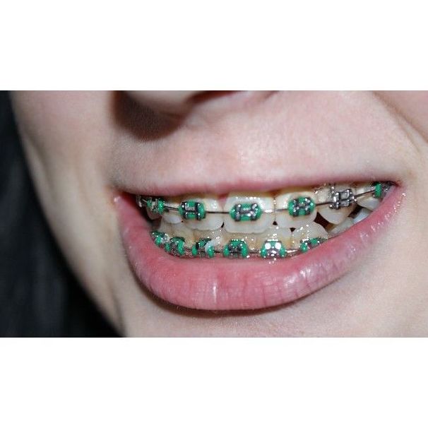 Ortodoncia: Tratamientos de MS Dental Ortodoncia: Tratamientos de MS Dental
