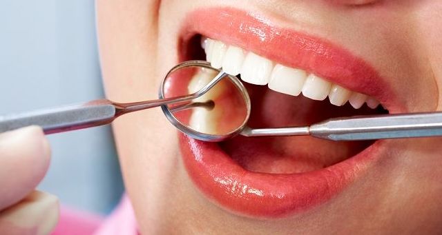 Limpieza Dental GRATIS: Tratamientos de Maribel Soto Vera - MS Dental