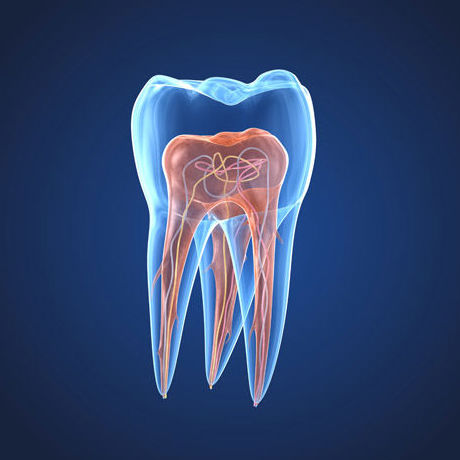 ENDODONCIA: Tratamientos of Clínica Dental Santa Eulàlia ENDODONCIA: Tratamientos of Clínica Dental Santa Eulàlia