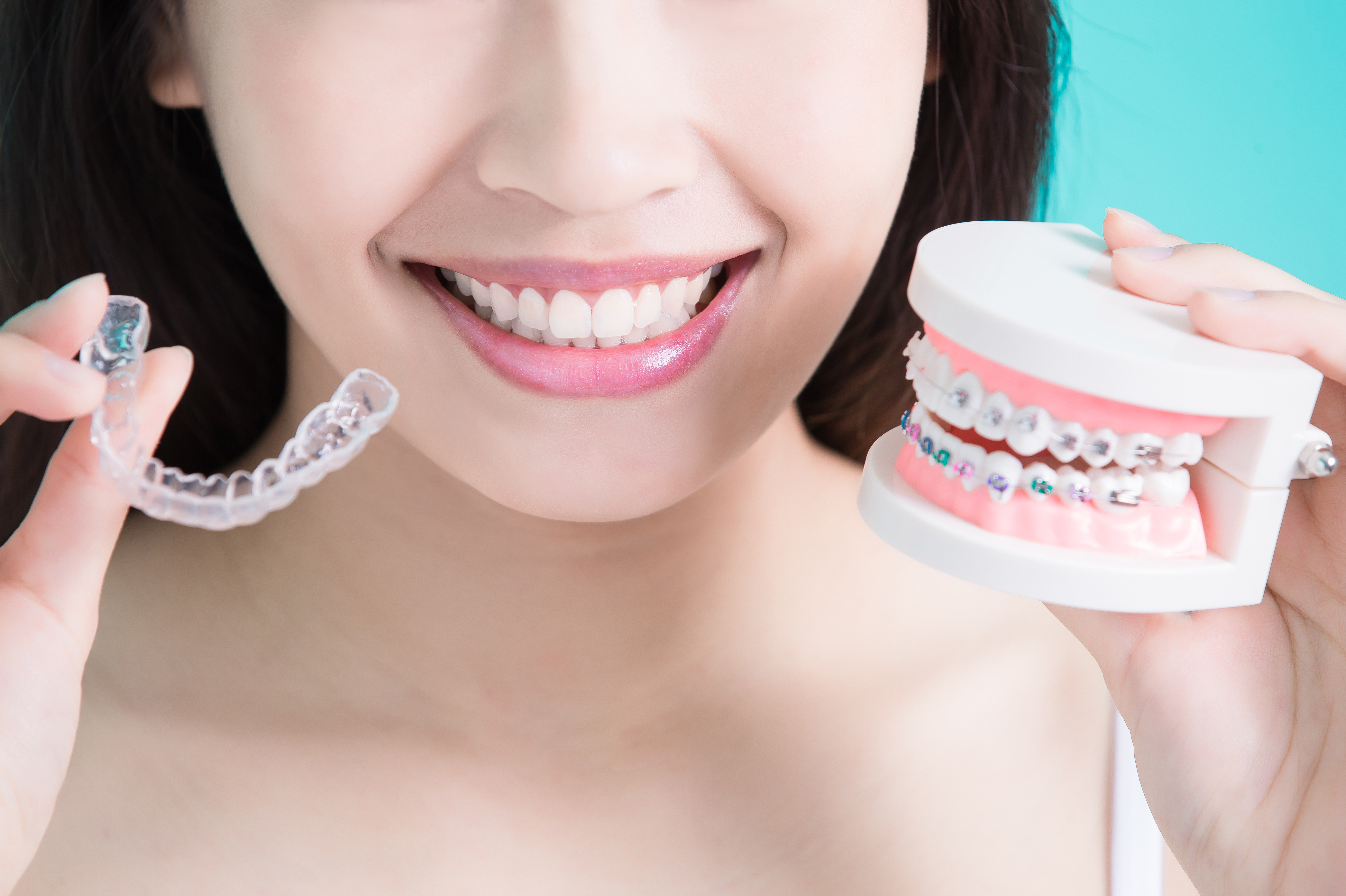 ORTODONCIA CON BRACKETS: Tratamientos de Clínica Dental Santa Eulàlia ORTODONCIA CON BRACKETS: Tratamientos de Clínica Dental Santa Eulàlia