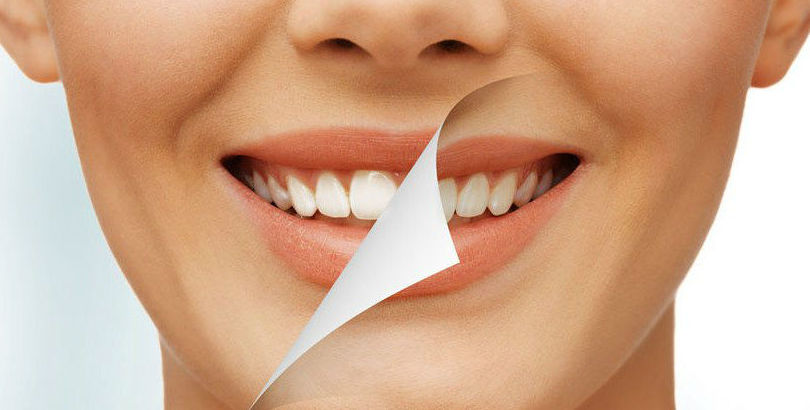 ESTÉTICA DENTAL: Tratamientos de Clínica Dental Santa Eulàlia ESTÉTICA DENTAL: Tratamientos de Clínica Dental Santa Eulàlia