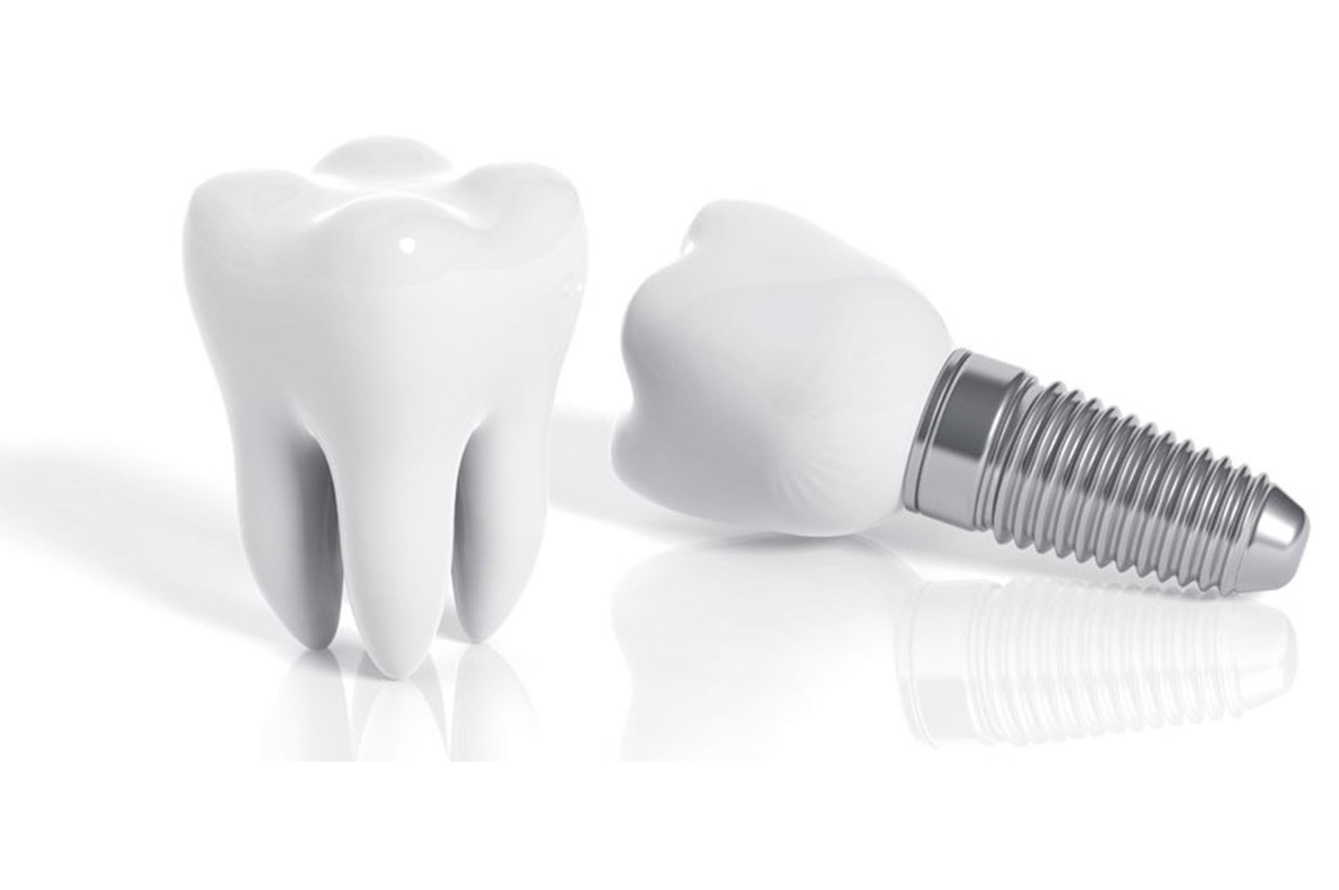 IMPLANTES: Tratamientos de Clínica Dental Santa Eulàlia IMPLANTES: Tratamientos de Clínica Dental Santa Eulàlia