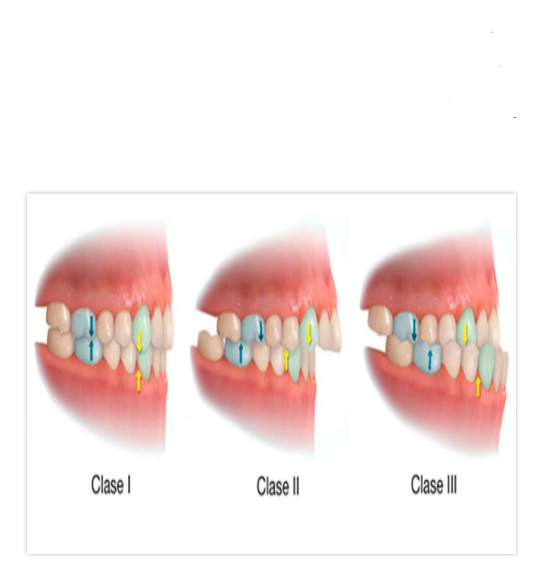ortodoncia: Servicios de CLÍNICA DENTAL LAS REDES ortodoncia: Servicios de CLÍNICA DENTAL LAS REDES