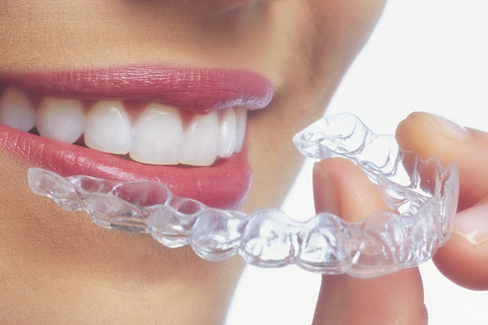 ortodoncia: Servicios de CLÍNICA DENTAL LAS REDES ortodoncia: Servicios de CLÍNICA DENTAL LAS REDES