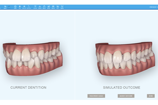 Ortodoncia invisible: Servicios de CLÍNICA DENTAL LAS REDES Ortodoncia invisible: Servicios de CLÍNICA DENTAL LAS REDES
