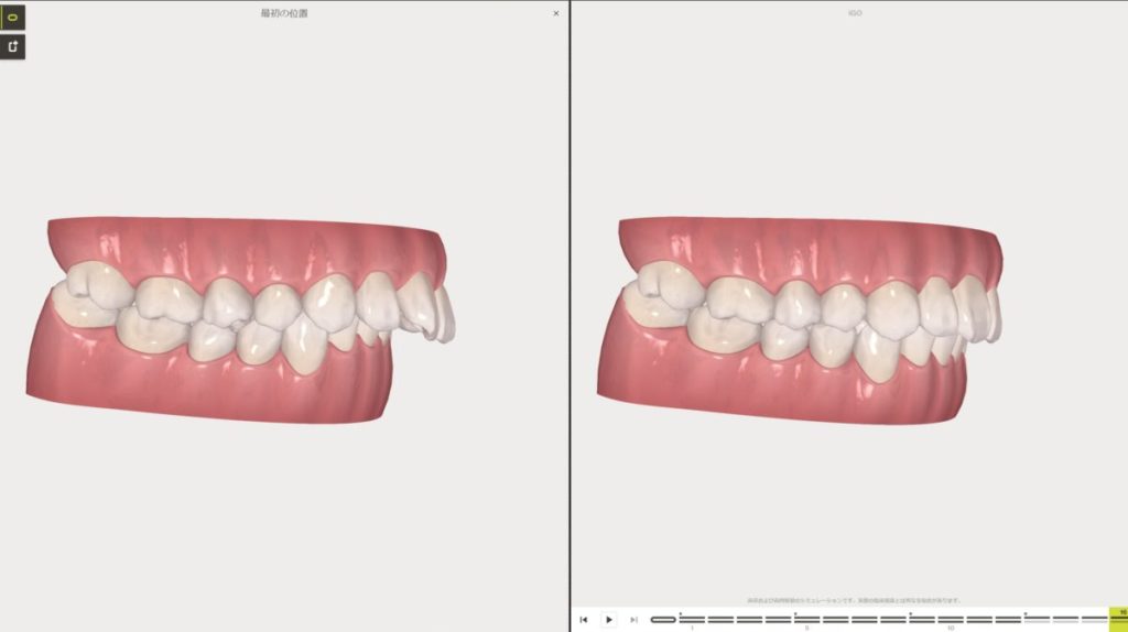 Ortodoncia invisible: Servicios de CLÍNICA DENTAL LAS REDES Ortodoncia invisible: Servicios de CLÍNICA DENTAL LAS REDES