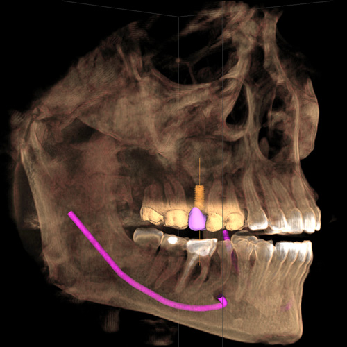 TAC DENTAL: Servicios de CLÍNICA DENTAL LAS REDES TAC DENTAL: Servicios de CLÍNICA DENTAL LAS REDES
