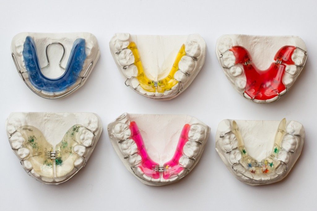 ortodoncia: Servicios de CLÍNICA DENTAL LAS REDES ortodoncia: Servicios de CLÍNICA DENTAL LAS REDES