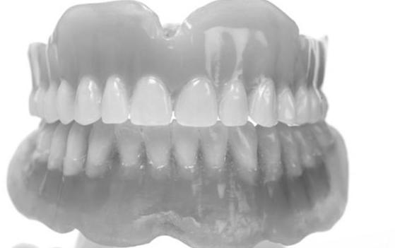 Prótesis: Catálogo de Edent Clínica Dental - Dra. Celia Caba Prótesis: Catálogo de Edent Clínica Dental - Dra. Celia Caba