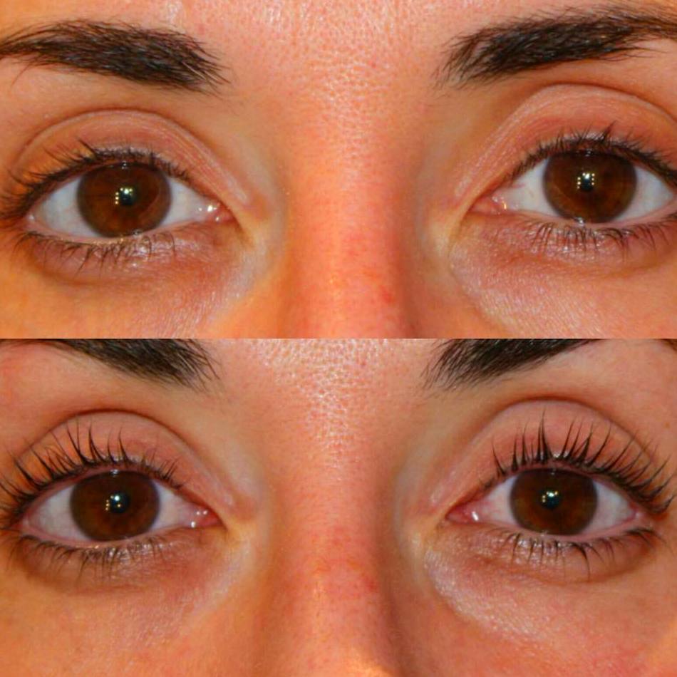 Lifting pestañas: Servicios de SMART expertos belleza Lifting pestañas: Servicios de SMART expertos belleza