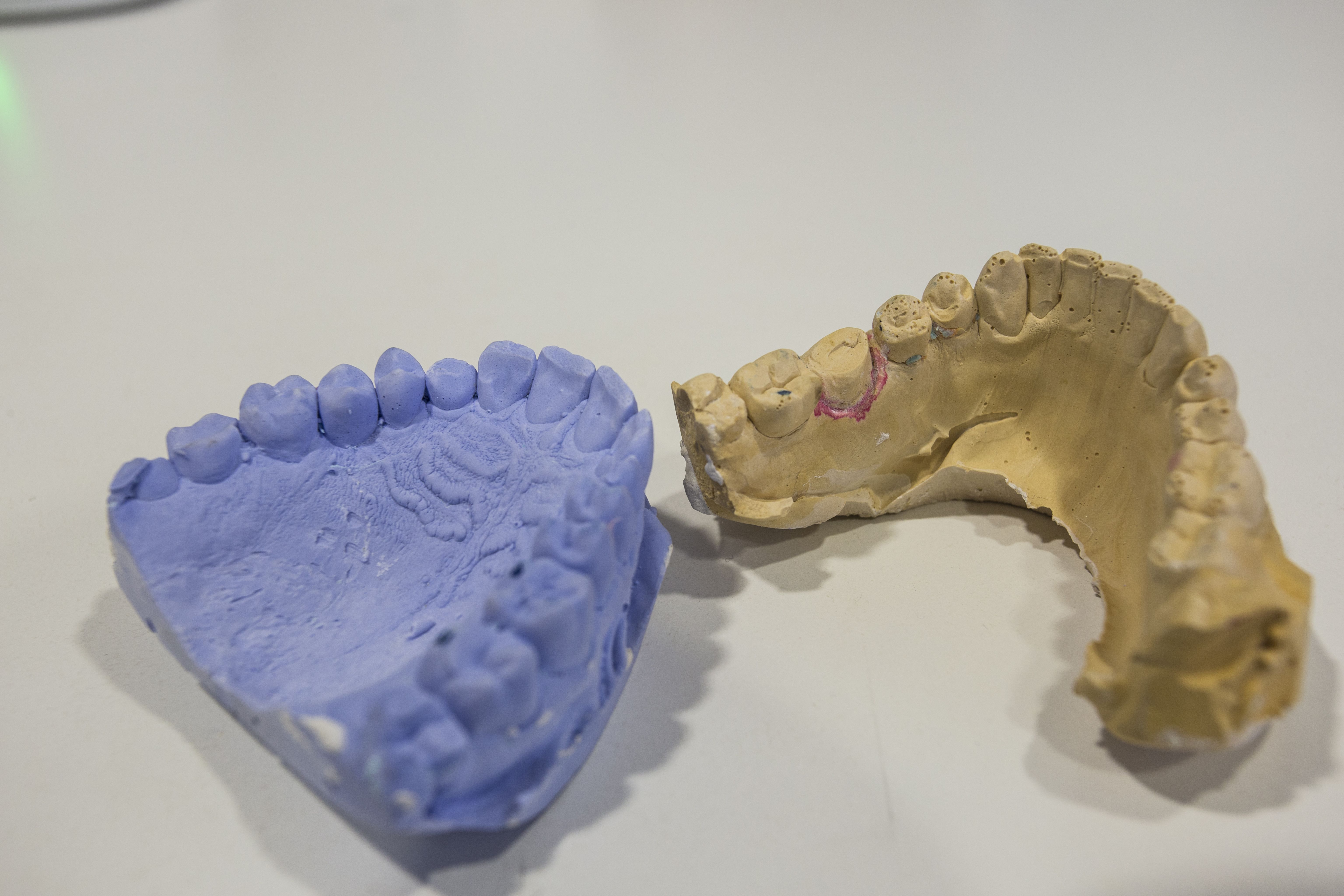 Implantes dentales en León