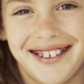 Aparatología Removible: Servicios de Clínica Dental Prat Casanovas