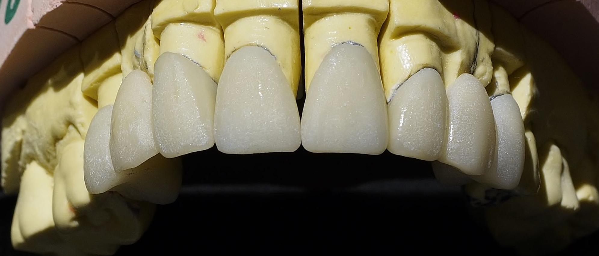 Foto 6 de Protésicos dentales en  | Calidad Tecnident 98, S.L.