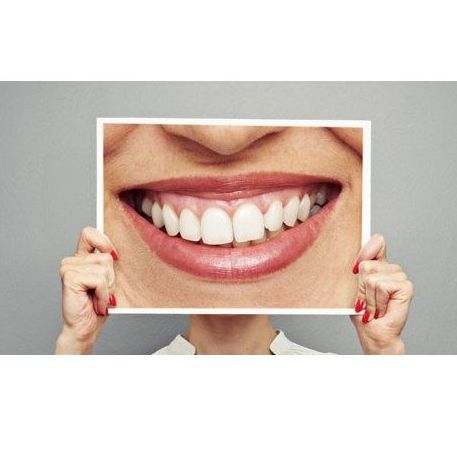 Blanqueamiento dental: Tratamientos de Dentamia Blanqueamiento dental: Tratamientos de Dentamia