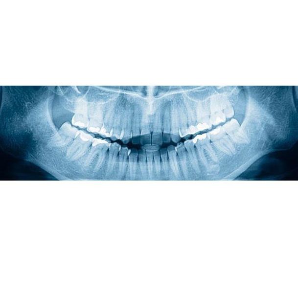 Radiología panorámica: Tratamientos de Dentamia Radiología panorámica: Tratamientos de Dentamia