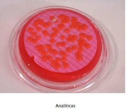 ¿Qué es la legionella?: Servicios de Exterplagas ¿Qué es la legionella?: Servicios de Exterplagas