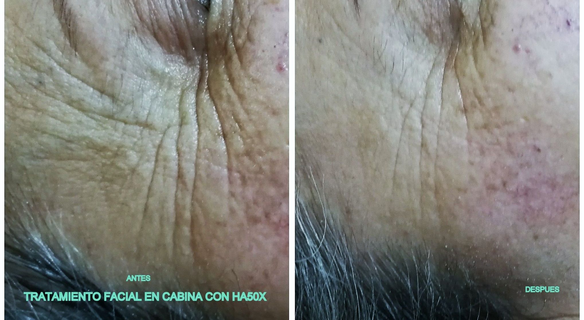 Tratamientos faciales : Servicios de La Xana Tratamientos faciales : Servicios de La Xana