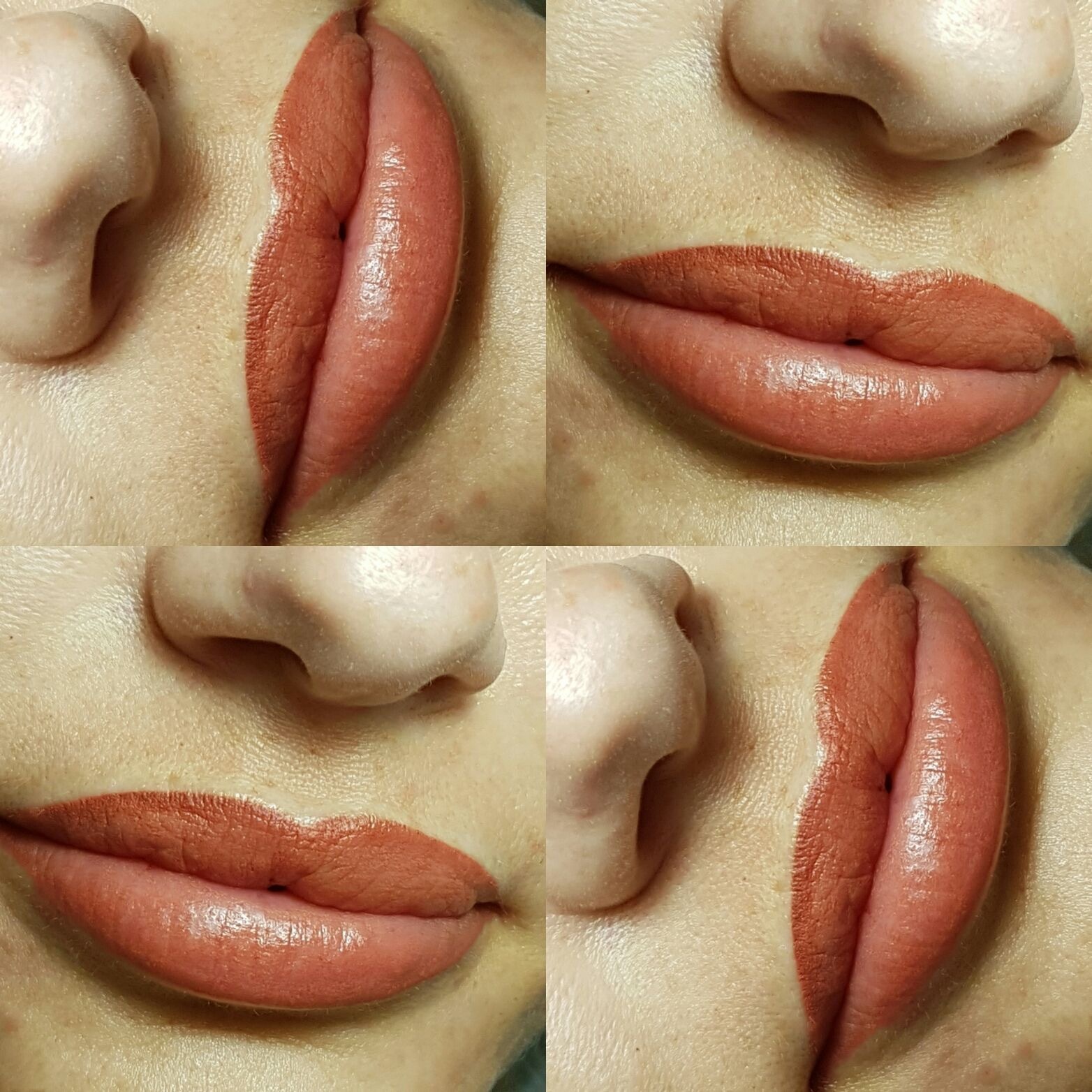 Tratamiento facial Tratamiento facial