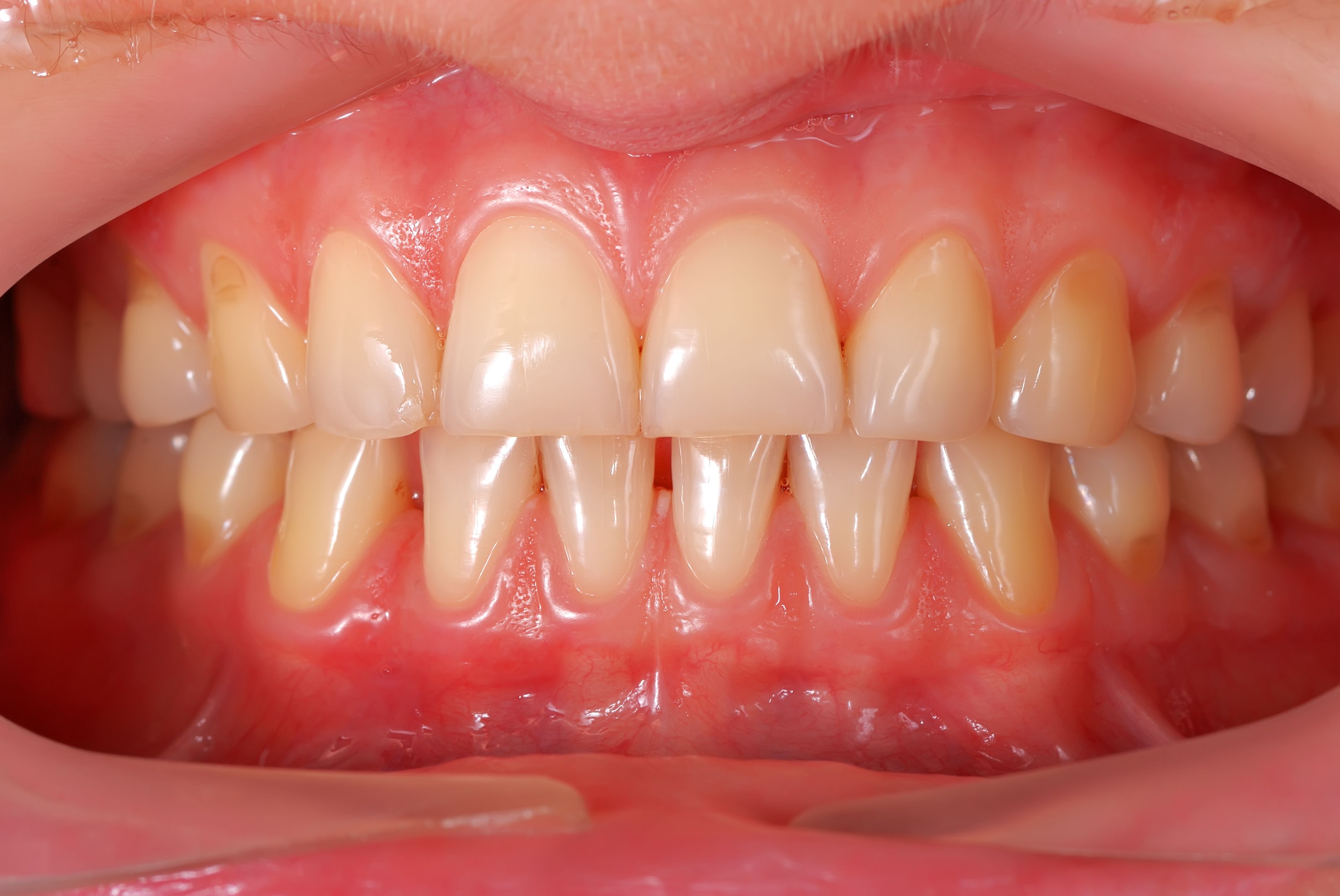 Periodoncia: Tratamientos de Clínica Dental Morilla