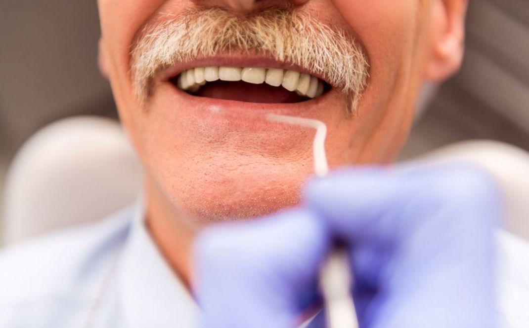 Prótesis dental Prótesis dental