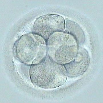 Infertilidad sin causa orgánica: Tratamientos de Psicoterapia y Psicoanálisis Infertilidad sin causa orgánica: Tratamientos de Psicoterapia y Psicoanálisis