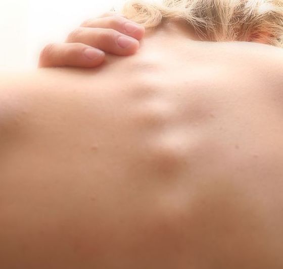 Enfermedades psicosomáticas: Tratamientos de Psicoterapia y Psicoanálisis Enfermedades psicosomáticas: Tratamientos de Psicoterapia y Psicoanálisis