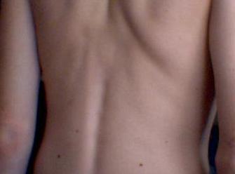 Fsioterapia preventiva : Tratamientos de Fisioterapia T-Cuida Fsioterapia preventiva : Tratamientos de Fisioterapia T-Cuida
