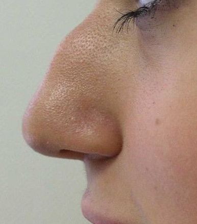 Otras ramas: Tratamientos de Fisioterapia T-Cuida Otras ramas: Tratamientos de Fisioterapia T-Cuida