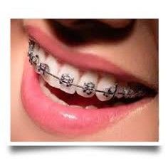 Ortodoncia: Tratamientos de VERÓNICA URZÚA JATIB