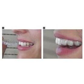Ortodoncia: Tratamientos de Centro Dental Innova Ortodoncia: Tratamientos de Centro Dental Innova