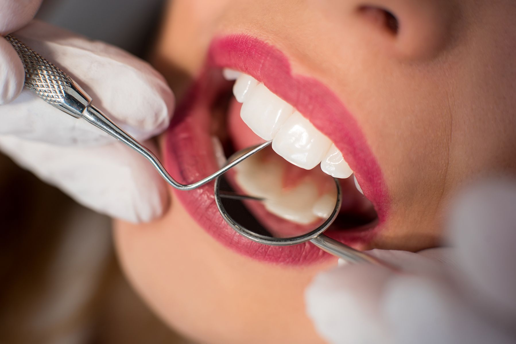 Especialistas en implantes dentales Fuenlabrada