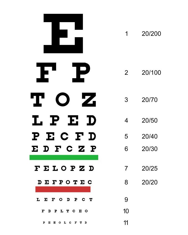 Optometría: Catálogo de Centro Óptico Romero