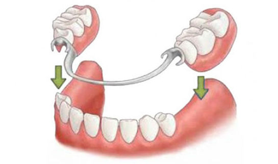 PROTESIS REMOVIBLES: Catálogo de Samuel Cumplido Santiago, Dr. PROTESIS REMOVIBLES: Catálogo de Samuel Cumplido Santiago, Dr.