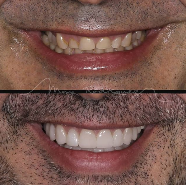 Estética y diseño de la sonrisa: Nuestros Tratamientos de Clínica Dental Rafael Menéndez Estética y diseño de la sonrisa: Nuestros Tratamientos de Clínica Dental Rafael Menéndez