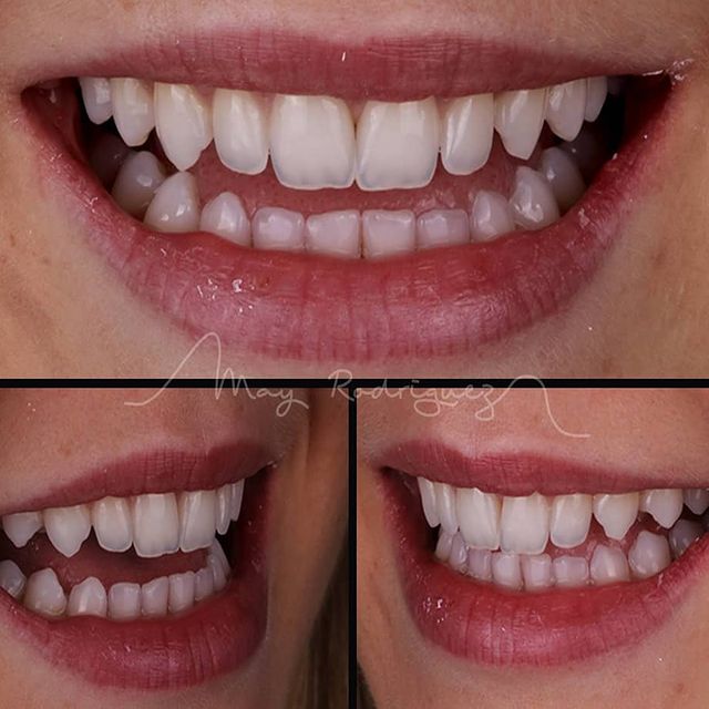May Rodríguez Villamizar: Nuestros Tratamientos de Clínica Dental Rafael Menéndez May Rodríguez Villamizar: Nuestros Tratamientos de Clínica Dental Rafael Menéndez