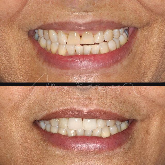 May Rodríguez Villamizar: Nuestros Tratamientos de Clínica Dental Rafael Menéndez May Rodríguez Villamizar: Nuestros Tratamientos de Clínica Dental Rafael Menéndez