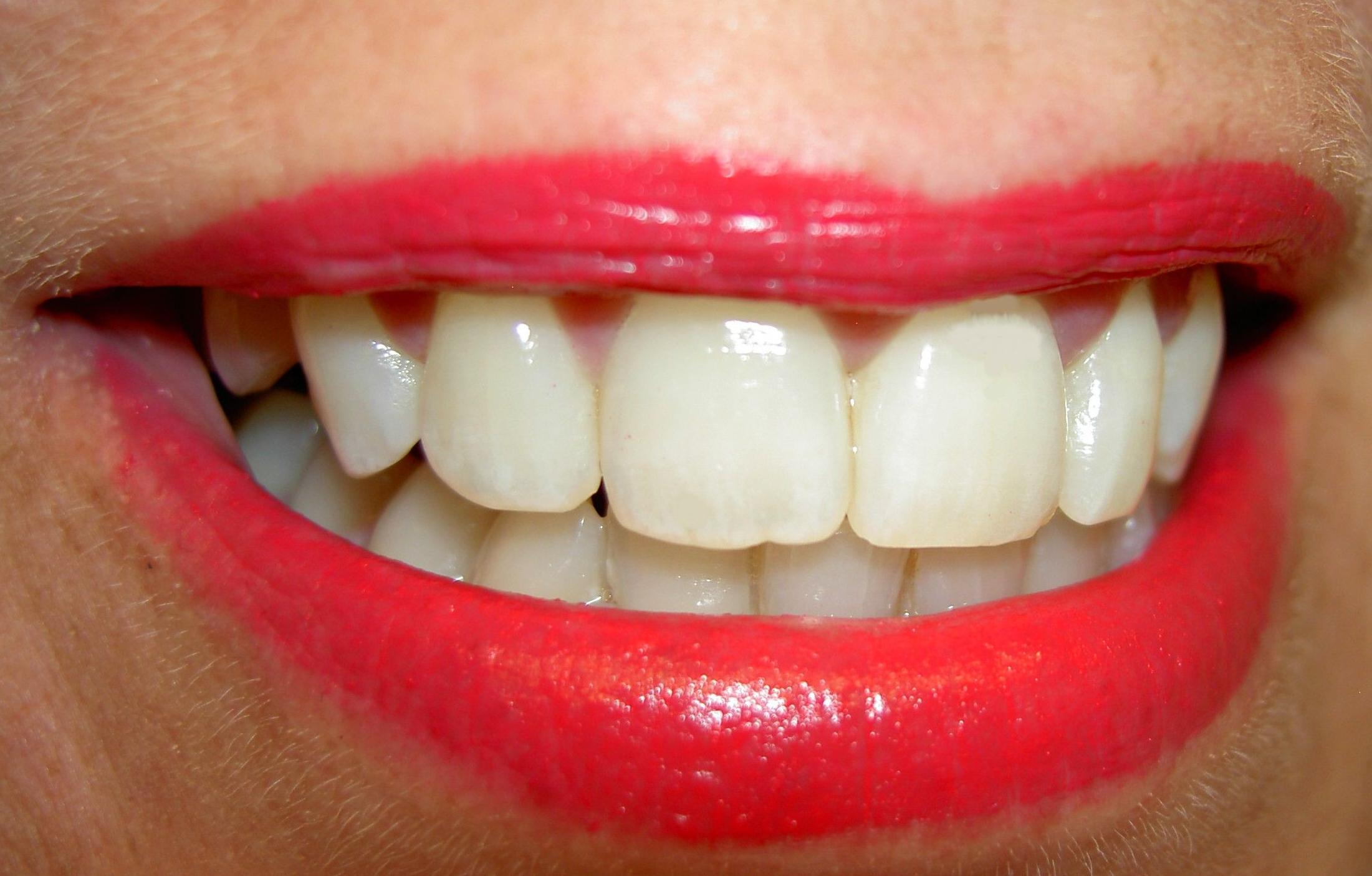 Obturaciones : Nuestros Tratamientos de Clínica Dental Rafael Menéndez Obturaciones : Nuestros Tratamientos de Clínica Dental Rafael Menéndez