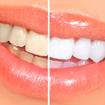 Estética dental Estética dental