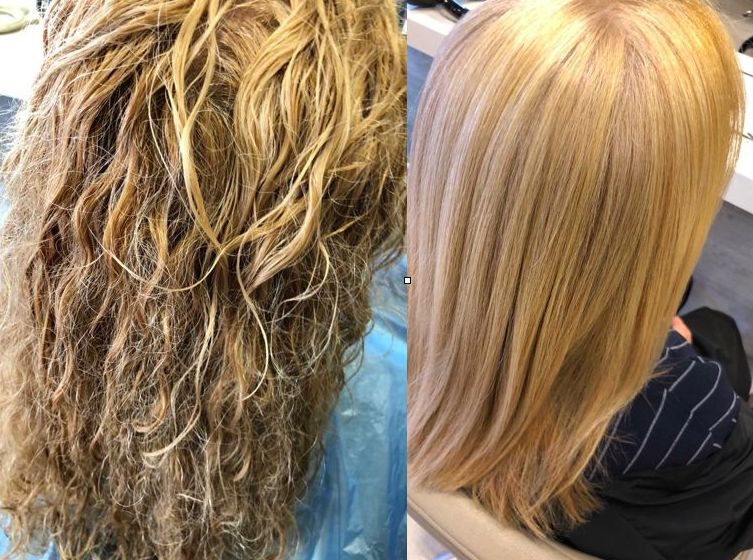 Taninoplastia en Madrid Sonia Atanes Taninoplastia en Madrid Sonia Atanes