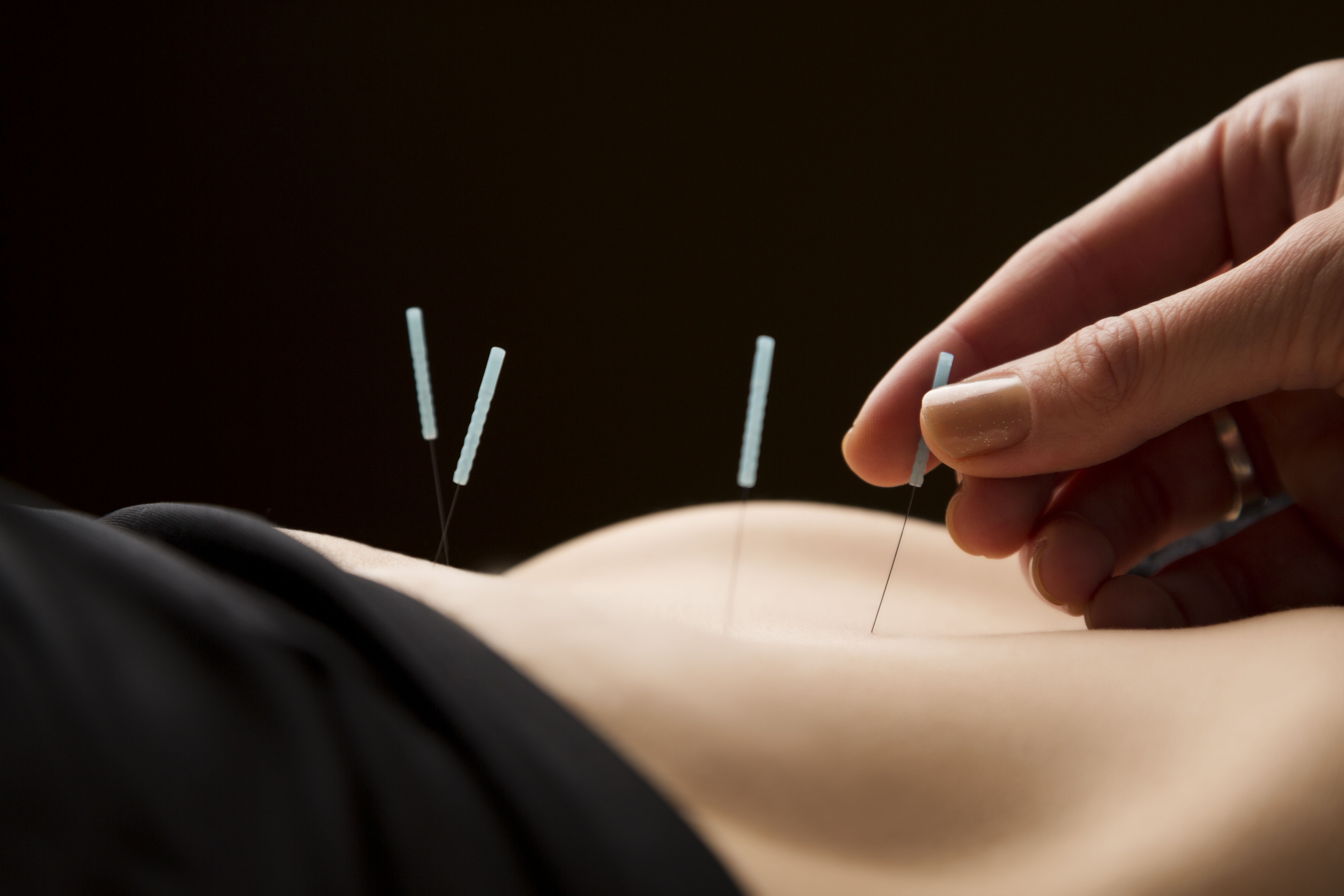 Acupuntura: Salud y Belleza de Herbolario Salud y Belleza Acupuntura: Salud y Belleza de Herbolario Salud y Belleza