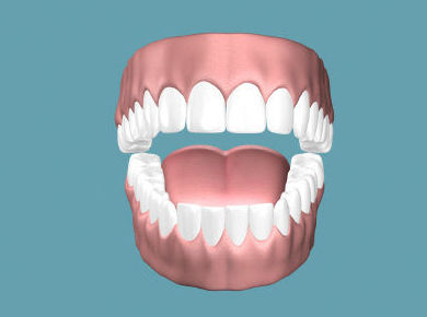 Implantes dentales Zaragoza