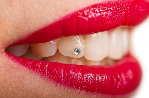 Joya Dental: Tratamientos de Clínica Dental Les Mèlies Joya Dental: Tratamientos de Clínica Dental Les Mèlies