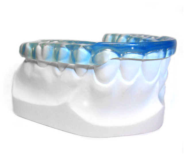 Férula de descárga: Tratamientos de Clínica Dental Les Mèlies Férula de descárga: Tratamientos de Clínica Dental Les Mèlies