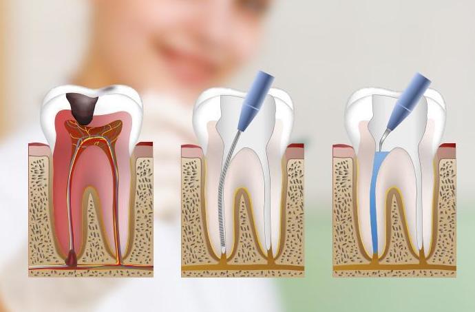 Limpieza, empastes y endodoncias: Catálogo de Centro de Salud Dental FamilDent Limpieza, empastes y endodoncias: Catálogo de Centro de Salud Dental FamilDent