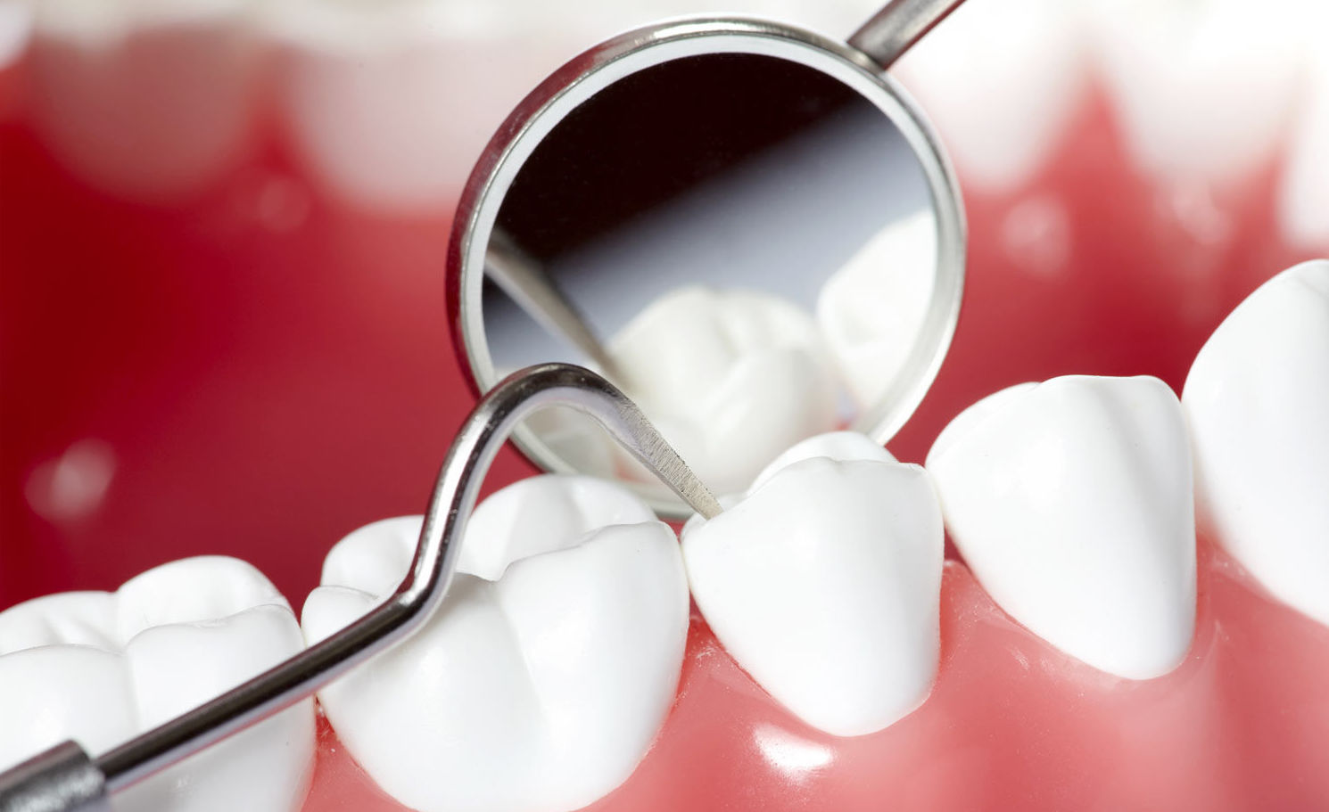 Periodoncia: Catálogo de Centro de Salud Dental FamilDent Periodoncia: Catálogo de Centro de Salud Dental FamilDent