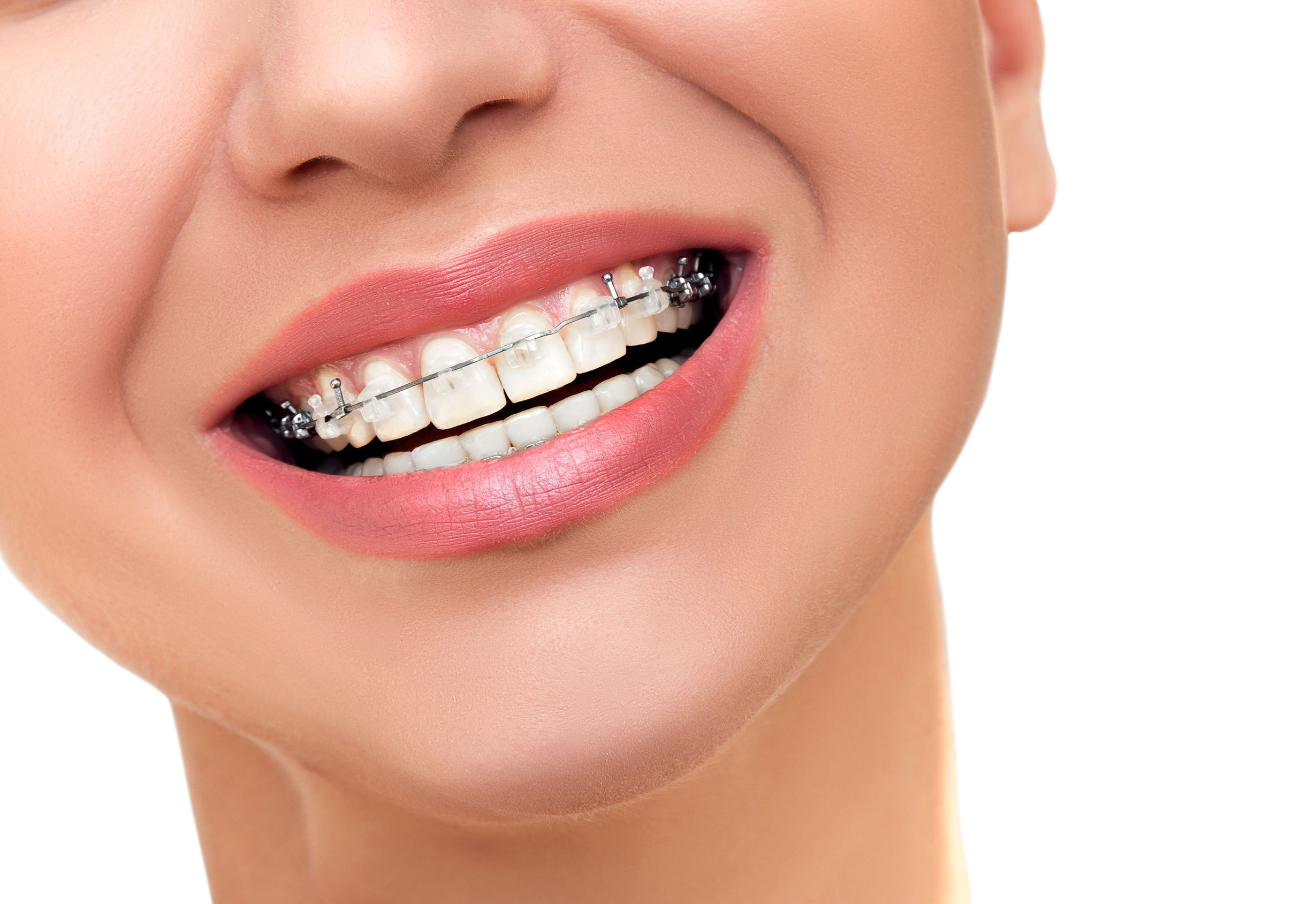 Ortodoncia: Catálogo de Centro de Salud Dental FamilDent Ortodoncia: Catálogo de Centro de Salud Dental FamilDent