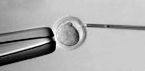 Fertilización in vitro: SERVICIOS de Instituto Grimalt