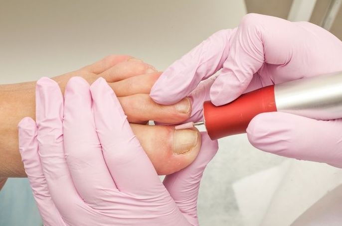 Pie diabético y de riesgo: Servicios de Clínica del pie Cavaleri Centro Pie diabético y de riesgo: Servicios de Clínica del pie Cavaleri Centro