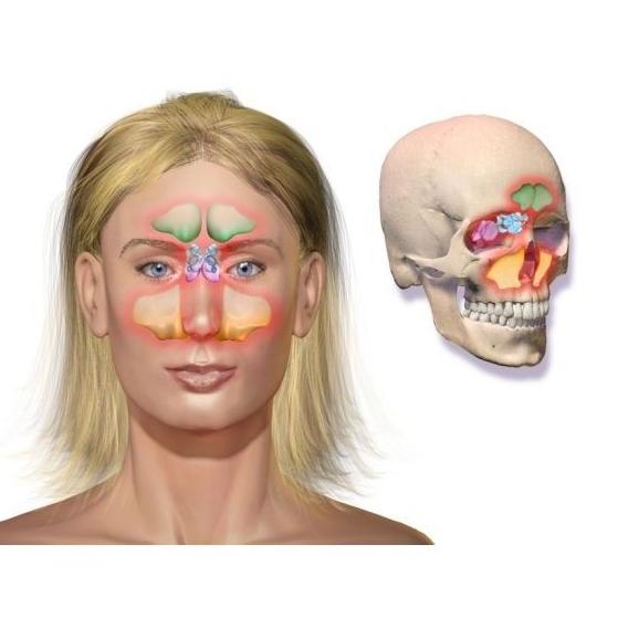 Sinusitis: Servicios de Miguel Ángel Ojeda Rodríguez Sinusitis: Servicios de Miguel Ángel Ojeda Rodríguez