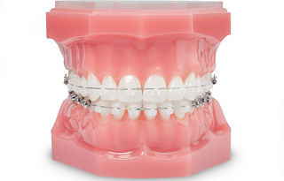 Brackets: Tratamientos y Aparatos de Dra. Amaia Goena Brackets: Tratamientos y Aparatos de Dra. Amaia Goena